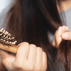 PGMA Module 5 Hair Loss