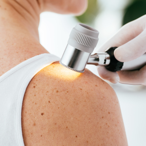 Going beyond the surface – Advancing Care in Atopic Dermatitis and Skin Health